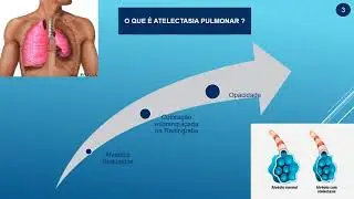 Resolução de exercício em vídeo sobre Respiração Pulmonar - NPC - Samuel Malveira