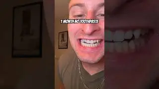 1 MONTH NO TOOTHPASTE