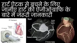 CT coronary angiography हार्टकी ऐंजीओग्राफि #coronaryarterydisease #heartangiography #coronarycare