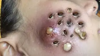 𝐄𝐧𝐣𝐨𝐲 𝐭𝐡𝐞 𝐬𝐮𝐫𝐩𝐫𝐢𝐬𝐞 𝐟𝐫𝐨𝐦 𝐋𝐨𝐚𝐧𝐍𝐠𝐮𝐲𝐞𝐧 #561828885
