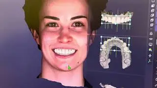 3D - cканирование лица