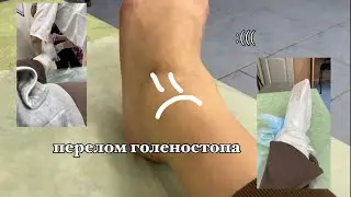 я лошара или же как я сломала ногу