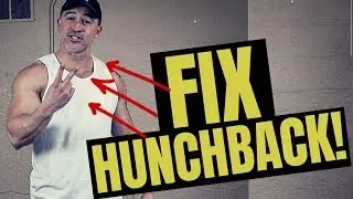 BEST Exercises To Get Rid Of Hunchback Fast (try these!)