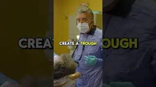 Don’t be so hard on yourself when extracting a tooth! #dentistrylife #dentisteducation #doctorvlog