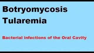 Botryomycosis; Tularemia: Bacterial infections of the Oral Cavity