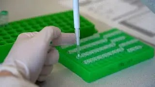 Hokej pomáhá i v laboratoři. Milionový přístroj už je v Motole