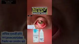 Eye flue treatment how to use in moxifloxacin eye drop full video link 👇