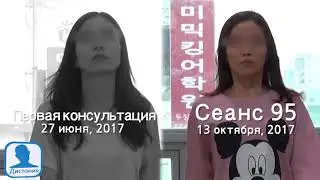 Спастическая кривошея / Пример лечения Дистония