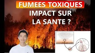 Incendies en Gironde et santé : quels risques liés à la fumée ?