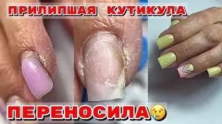 ПЕРЕНОСИЛА НОГТИ 💅 Маникюр маме 💅 Прилипшая кутикула