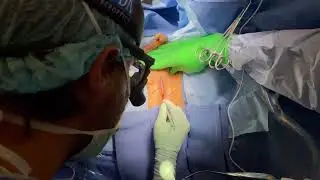 Core Videos (2021): Perineal Urethrostomy with Z-Plasty Flap