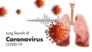 Sounds of Coronavirus (COVID-19) - Lung Sounds