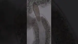 Amoeba captures paramecium 6 #shorts