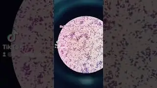 Gram positive cocci identification 