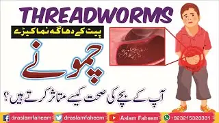 How To Get Rid of Pinworms / Threadworms | Causes, Symptoms and Treatment of Threadworm
