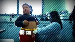 Câmera Record - 30/07/2014 - O Menino de 5 Anos que Pesa 60Kg