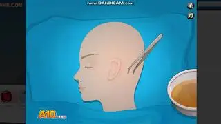 Operate now!=Epilepsy Surgery(No Commentary)