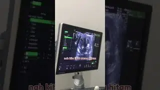 JENGUK DEBAY DI TRIMESTER 2 