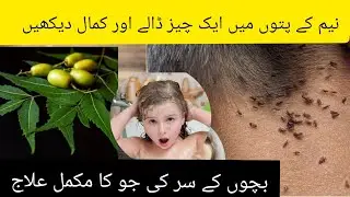 Say "Bye Bye" Forever to Head Lice #lice #treatment nidi creation