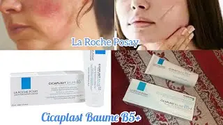شنو عطاني الطبيب لعلاج جميع مشاكل انواع البشرة Cicaplast Baume B5 حروق الشمس ندوب قديمة حب الشباب...