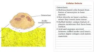 Cellular Defects -  Osteoblasts, Osteoclasts  and Osteocytes