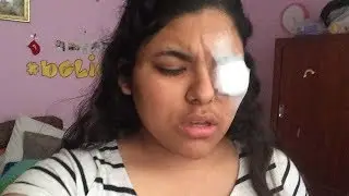 LASIK GONE WRONG | Storytime
