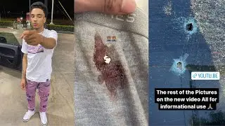 JAY CINCO GOT SHOT OMG😲ALMOST LOST HIS LIFE