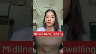 Midline neck swelling - What could be the reason? #medicine #neet #neetpg #doctor #biology #neetpg