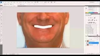 Photoshop smile simulation
