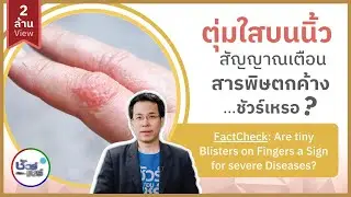 ชัวร์ก่อนแชร์ : ตุ่มน้ำใสบนนิ้ว คือสัญญาณเตือนโรคร้ายจากสารพิษตกค้างจริงหรือ?