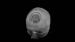 Beyond an MRI