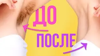 ВОЛОСЫ НА ТЕЛЕ: КАК УДАЛИТЬ НАВСЕГДА