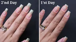 How to grow nails in 2 days || How to grow nails fast overnight || How to grow nails fast||