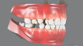 Dental Development 45