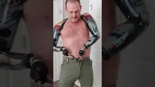 Amputee Dresses with Style