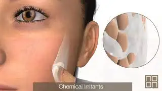 DermShield Technology   Short Version