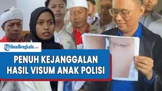 Pengacara Guru Supriyani Ragukan Hasil Visum Anak Aipda WH, Penuh Kejanggalan