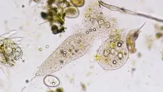 Microbiology 101: Microscopy (Lecture 2 of 12)