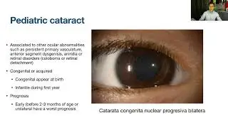 Lecture: Surgical Approach to Pediatric Cataracts