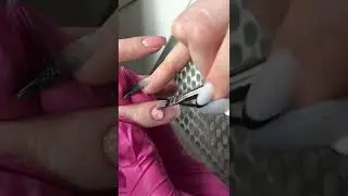 Раздражает гель лак 