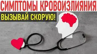 ВНИМАНИЕ! Это симптомы инсульта НЕ ПРОПУСТИ ПРИЗНАКИ ИНСУЛЬТА