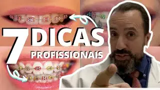 7 Dicas Profissionais Para Quem Usa Aparelho Ortodôntico