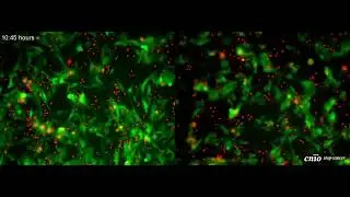 T cell killing video