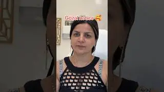 Möhtəşəm dəyişim #NigarSultanova #estetik #beforeandafter #beforeafter #öncesivesonrası #shorts