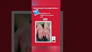 Hyperhidrosis@FreeMedicalEducation-ld3sf#medical#nursing#viralshortsvideo#Mbbs#youtubeviralshorts