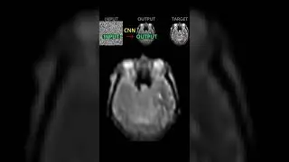 Visual Training of a CNN as a Denoiser (Deep Image Prior)