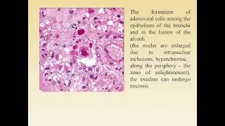 PA lecture viral infections_17032022