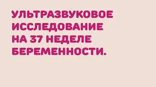 УЗИ на 37 неделе беременности