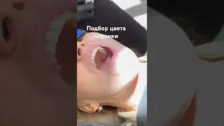 Коронка на зуб