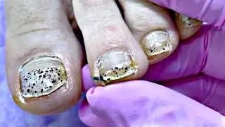 Gel Pedicure for Professional Dancer 💃